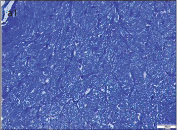 Electron Microscopic and Immunohistochemical Examination of the Effect of 2-Aminoethoxydiphenyl Borate on Optic Nerve Injury in A Rat Model