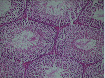 Protective Effect of Udenafil Against Ischemia Reperfusion Injury Due to Testicular Torsion/Detorsion in Rat Model