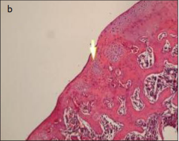 Histological Comparison of Nanocomposite Multilayer Biomimetic Scaffold, A Chondral Scaffold, and Microfracture Technique to Repair Experimental Osteochondral Defects in Rats